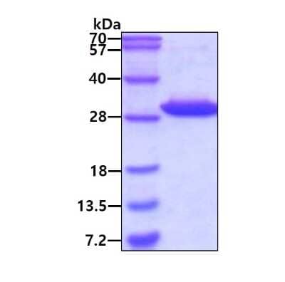 SDS-PAGE: Recombinant Human FAHD1 His Protein [NBP1-50983]